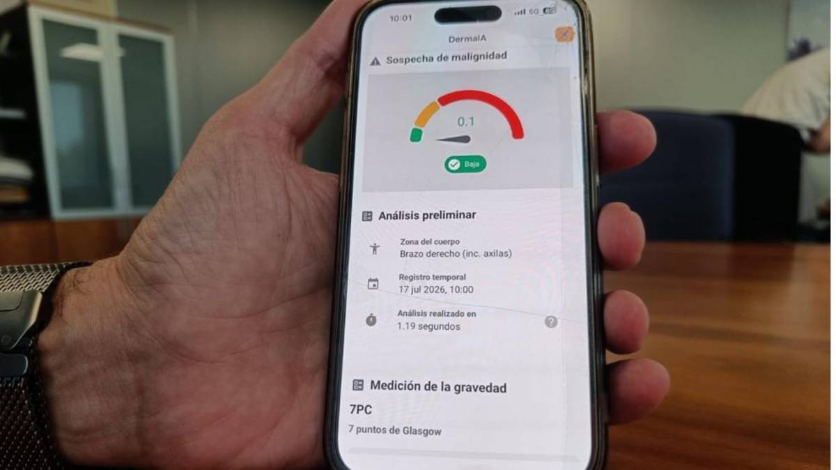 aragón | Aragón trabaja en una app que utiliza IA para mejorar la atención dermatológica